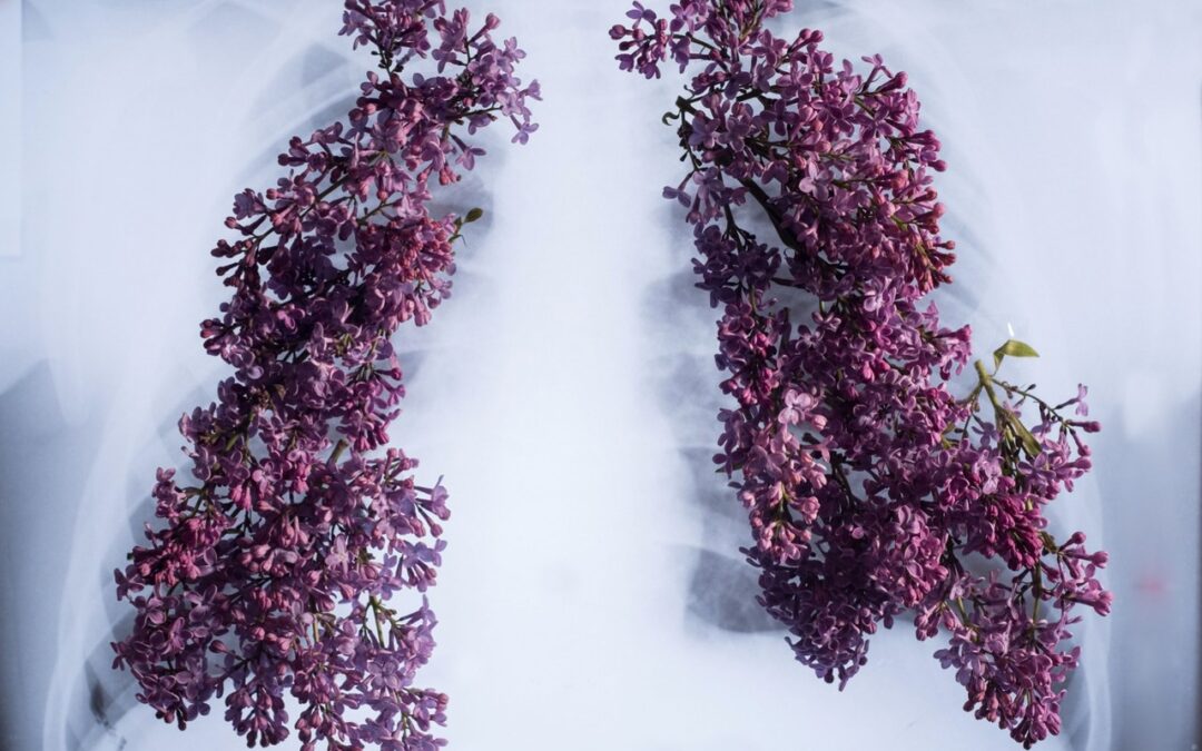 Czy rak płuca stał się chorobą przewlekłą?
