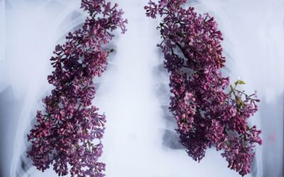 Czy rak płuca stał się chorobą przewlekłą?
